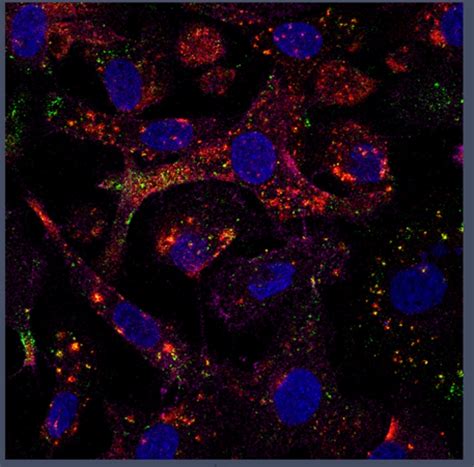 SKOV3 ovarian cancer cells - Laboratory of Precision and Nanomedicine