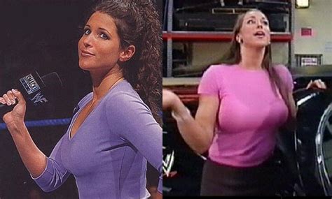 Stephanie Mcmahon Before And After Surgery