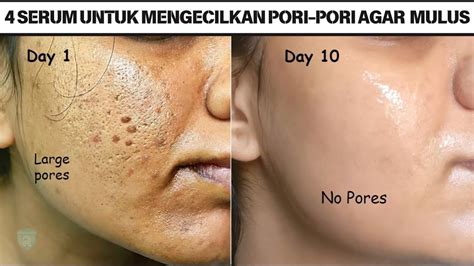 4 Serum Untuk Mengecilkan Pori Pori Agar Wajah Mulus Cocok Untuk Usia