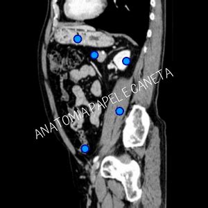 Jogos De Anatomia Humana Abdome Anatomia Papel E Caneta