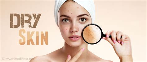 Dry Skin Xerosis Causes Symptoms Diagnosis Treatment Prevention