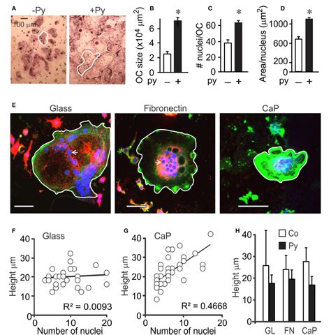 Figure 1 From Regulation Of Osteoclast Growth And Fusion By Mtorraptor And Mtorrictorakt