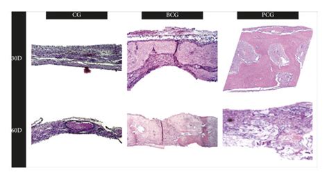 Photomicrographs Of Sections Stained With He 30 And 60 Postoperative Download Scientific