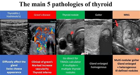 Medical Ultrasound Thyroid Ultrasound Medical Ultrasound Ultrasound