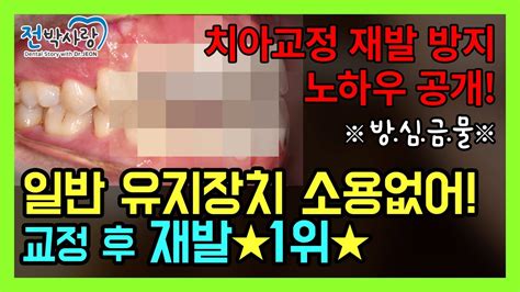 2 11치아교정 오랫동안 예쁘게 유지하는 노하우 공개 29년차 의사가 말한다 ☠방심하다가 망치는 교정치료☠ Youtube