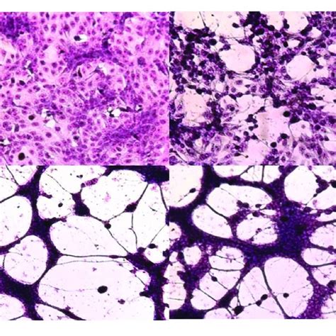 Cytopathic Effect On Vero Cells Of Hsv 1 F And Its Syncytial Variants Download Scientific