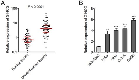 GIHCG Is Up Regulated In Cervical Cancer Tissues And Cell Lines A