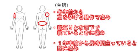 【20代】 男性 半年前から右肩に痛み 京都市下京区（西大路七条）の整体ならなかやま鍼灸整体院