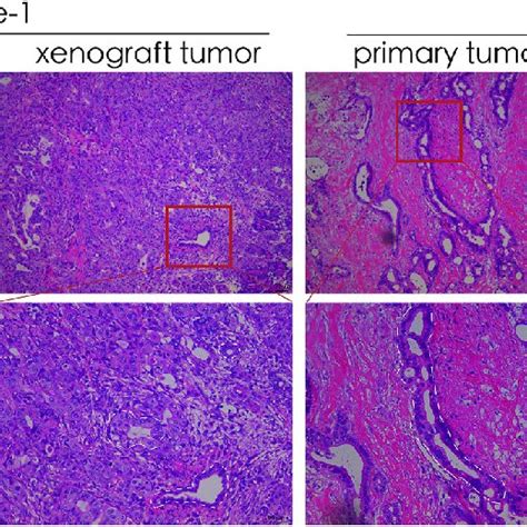 Two Representative Cases Of Hematoxylin And Eosin He Staining Of