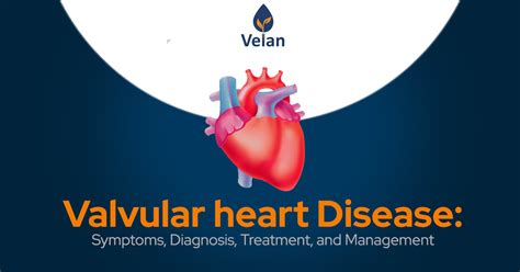 Valvular Heart Disease Symptoms Diagnosis Treatment And Management