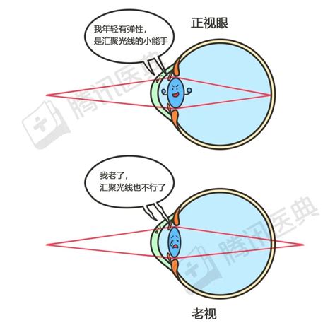 人老了会老花，能和近视中和恢复视力？这谬论你咋想出来的腾讯新闻