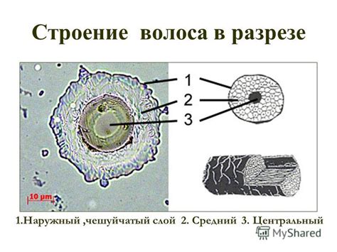 Презентация на тему: "Строение и функции волос. Уход за волосами ...