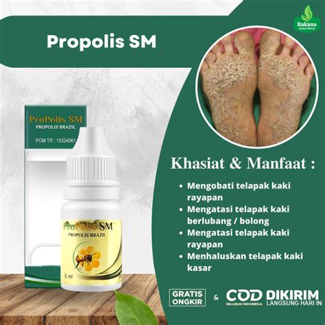 Jual Obat Telapak Kaki Bau Rayapan Bolong Bolong Penghilang Kutu Air