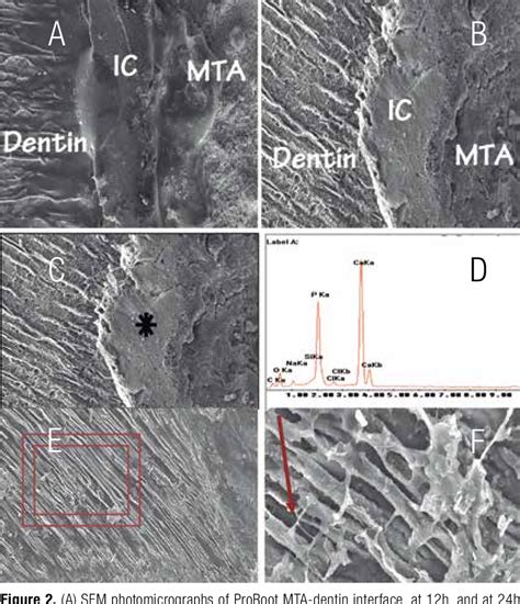 Figure 2 From Mineral Trioxide Aggregate And Calcium Hydroxide Promotes