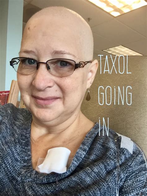 Wednesday December 20 Infusion Day Boob Gone Rogue