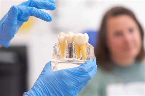 How Successful Are Dental Implants