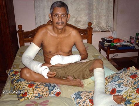 Kerala S TJ Joseph The Indian Teacher Whose Hand Was Cut Off For An