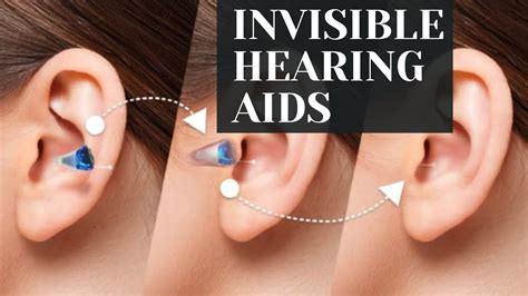 Invisible Hearing Aids Empower Your Hearing