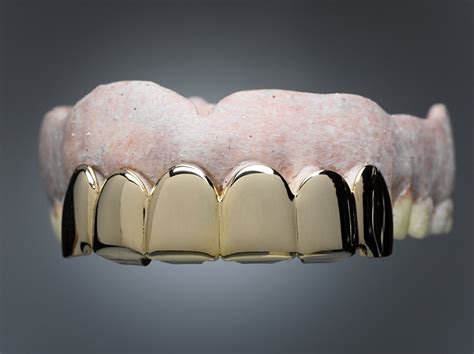 5 Stars With Gold Teeth Grills Or Encrusted Diamonds