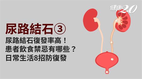 尿路結石／尿路結石5年復發率高達5成！患者日常要注意什麼？哪些食物不要吃？照護醫學百科結石復發率