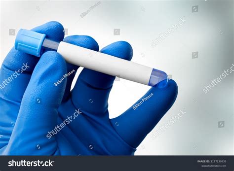 Test Medical Check Test Tube Biological Stock Photo