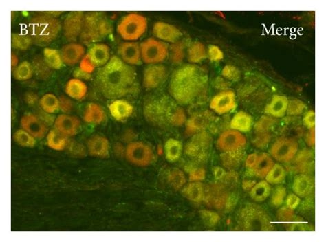 Double Labeling Immunofluorescence For Trpv Cgrp Ac And Df And