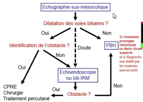 Syndrome De Cholestase Cartes Quizlet