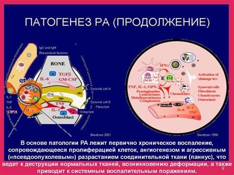 Ювенильный ревматоидный артрит - online presentation