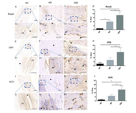 The Osteogenesis Related Genes Expression In Ossified Tendon Was