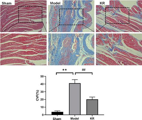 Kr Alleviates Myocardial Fibrosis And Cvf Via Masson Staining And