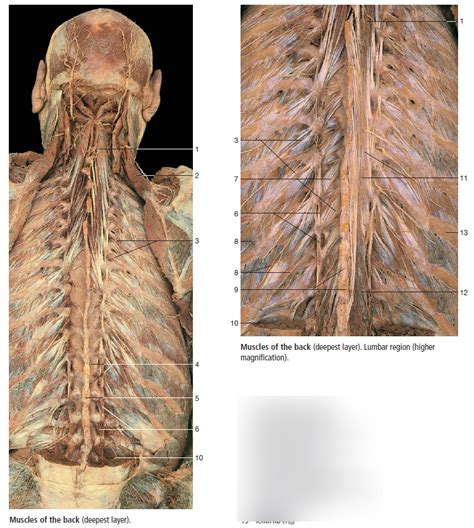 Intrinsic Back Muscles Cadaver Anatomy Diagram Quizlet The Best Porn