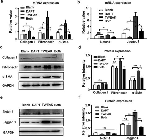 Notch Jagged Signal Inhibitor Dapt Mitigated The Effect Of Tweak On