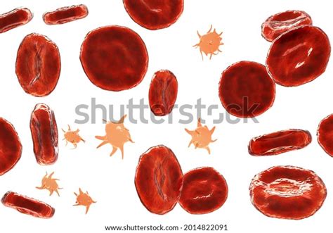 Activated Platelets Blood Smear Red Blood Stock Illustration