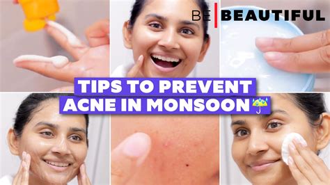 मॉनसून में मुंहासों से कैसे बचें Quick Tips To Control Acne In Rainy