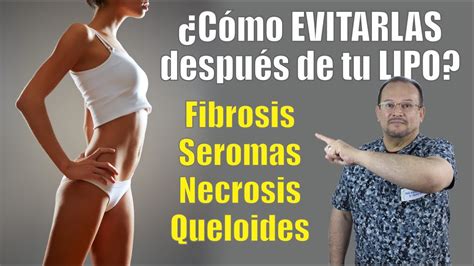 C Mo Evitar La Necrosis Fibrosis Seromas Y Queloides Post