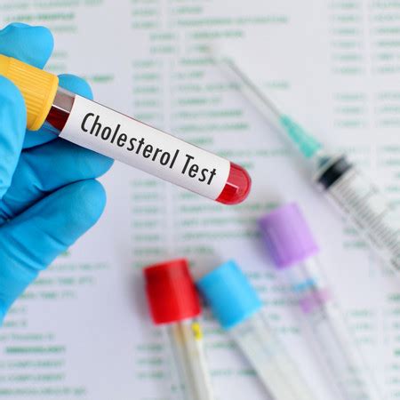 Pemeriksaan Cholesterol Total Di Laboratorium Klinik Trastia HDmall