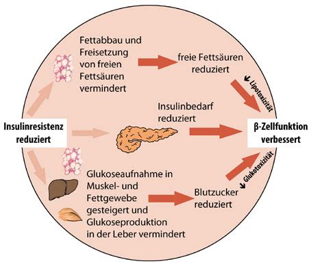 Das ist billig Souverän Trommel diabetes typ 2 therapie fest Dieb