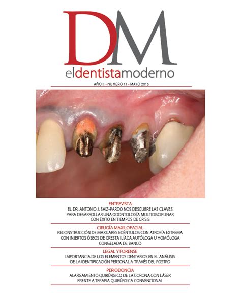 Descargar PDF El Dentista Moderno