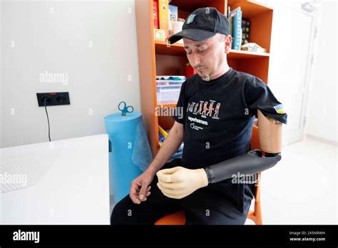 Man Training With His Prosthetic Arm At The Superhumans Center In Lviv