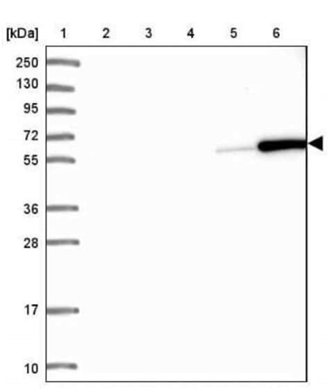 Coronin 1a Antibody Novus Biologicals 25 μL Unconjugated Fisher