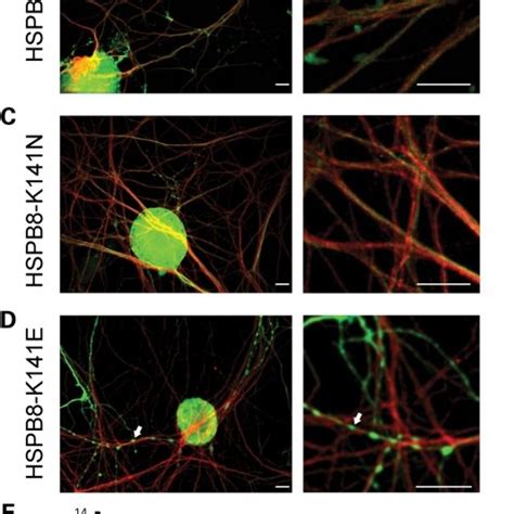 Mutant HSPB8 Induces Neurite Degeneration In A Small Proportion Of