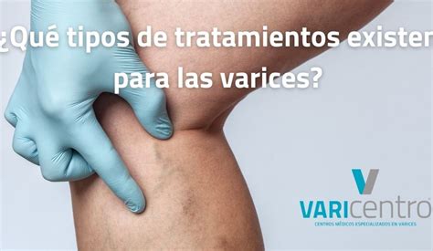 Información de Escleroterapia con líquido VARIcentro tratamiento de