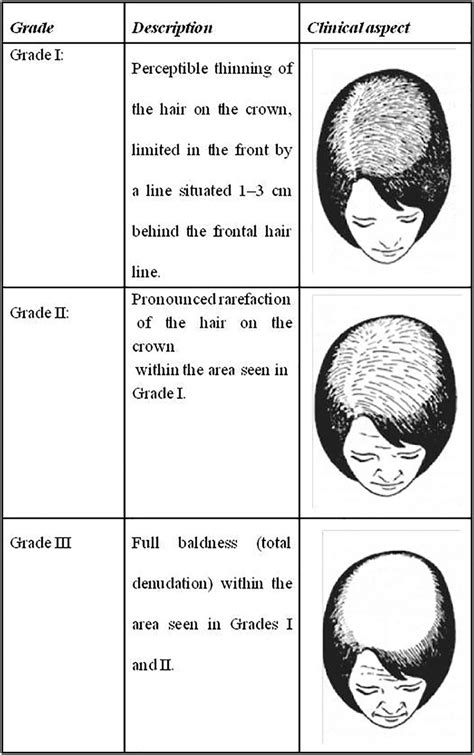 Ludwig Scale Representation Download Scientific Diagram