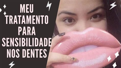 Tratando A Sensibilidade Nos Dentes YouTube