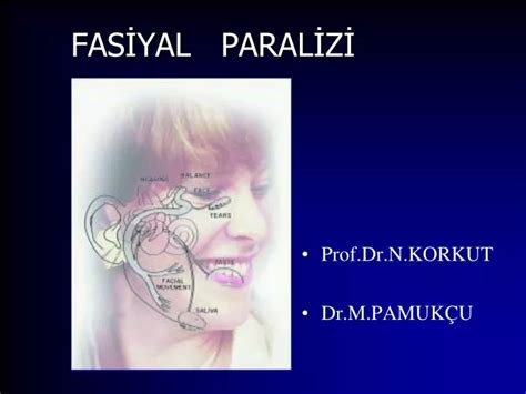 Ppt Fasİyal Paralİzİ Powerpoint Presentation Free Download Id 4380303