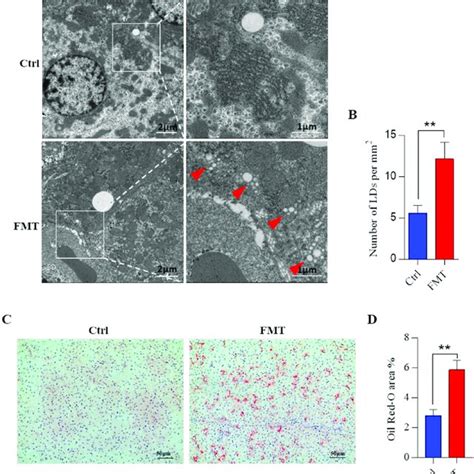 Histological Evaluation Of Hepatic Lipid Droplets Accumulation After