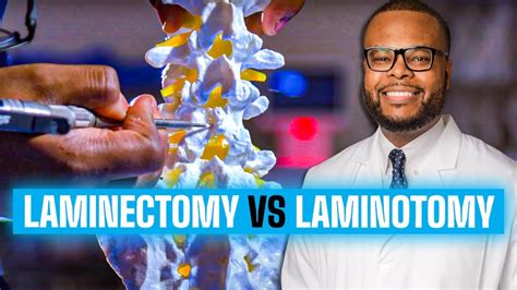 Laminectomy Vs Laminotomy Spinal Decompression Explained Youtube