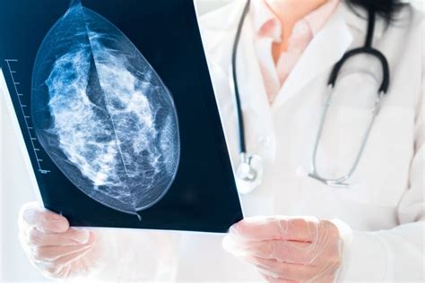 Bilateral Mammogram Vs 3D Mammogram Health Images