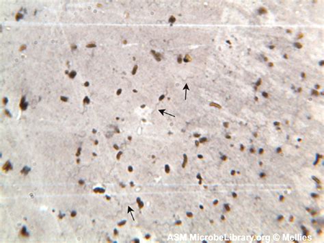 Biol 230 Lab Manual Monotrichous Arrangement Of Flagella Pseudomonas