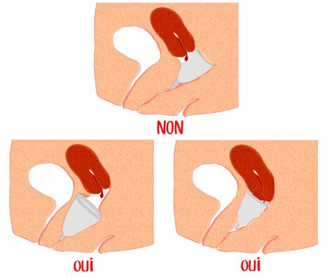 NO MÁS PÉRDIDAS CON LA COPA MENSTRUAL Ágata La Copita Menstrual